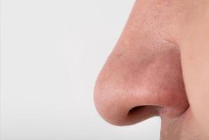 A man has a wide fleshy big nose, close-up. Nose reduction plastic surgery concept, copy space for text photo
