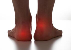Red spots on dark female legs. Concept of pain and inflammation from calluses and warts on the feet. Close-up photo