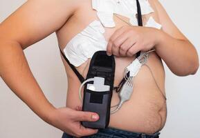 An obese man undergoes a Holter monitoring of the heart. A modern method for studying the heart in caodiology. Arrhythmia and ischemic disease. Medic photo