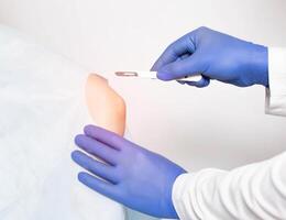 Doctor surgeon makes an incision with a scalpel on the elbow joint to replace an injured joint with an artificial joint replacement, capsular ligament apparatus photo