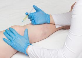 The doctor injects plasma into the knee joint of a woman to eliminate pain and symptoms of arthritis and arthrosis, relieve inflammation with a plasma-lifting method photo