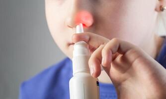 A caucasian girl sprays a spray into her nose to treat allergic rhinitis. Treatment of runny nose and nasal congestion with medical sprays, close-up photo