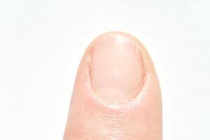 Close up view of a human fingertip highlighting nail and skin texture. photo