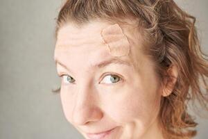 Caucasian female with bandage on forehead smiling close up. photo