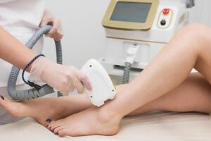 Laser epilation of legs photo