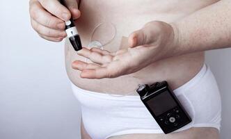 Diabetes management, insulin pump and glucose monitoring process in progress photo