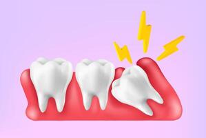 Illustration 3d realistic of wisdom tooth under gum cause of pain and lean on other teeth cause of tooth decay. Concept of pain in mouth, toothache, Mesh gradient wes used vector