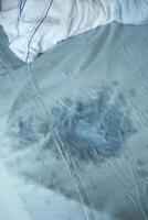 A visible stain on a light blue bedsheet photo