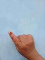 A dog bite wound and blood on hand. Infection and Rabies concept.Sarting of Rabies. photo