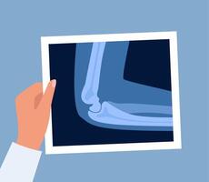 Xray scan of elbow joint. Anatomical structure, care and diagnosis for pain in arm. Roentgen shot in doctors hand. illustration. vector
