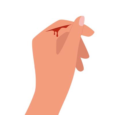 Bleeding cut on the palm, emergency situation. First aid treatment for wound on skin. Trauma, treatment procedure. illustration.
