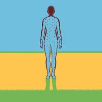 Understanding Body Spots A Guide to Common Skin Conditions vector