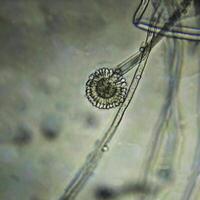 Aspergillus spore head in reflected light microscopy, highlighting delicate fungal structures and transparent spores photo