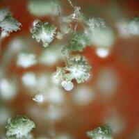 Aspergillus spore heads in reflected light microscopy, showing intricate fungal growth and blurred background photo