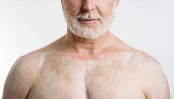 close-up of mature male with albinism showing pale skin texture, white beard, and distinct features on white background for medical and educational use photo