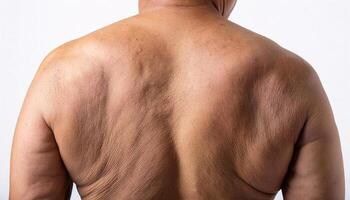 close-up of sagging skin on the back with natural folds and uneven texture in isolated white background photo
