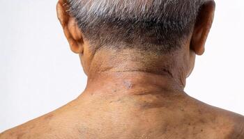 close-up of aged neck with visible folds, wrinkles, and rough skin texture highlighting signs of aging on isolated white background photo
