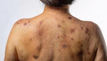 macro image of hyperpigmentation on the back showing dark spots wrinkles and signs of aging in isolated white background photo