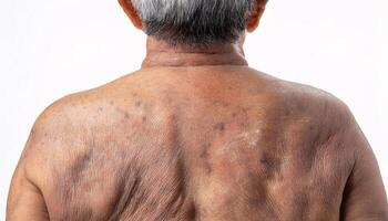Detailed view of aged skin on the lower back, with subtle folds, pigmentation, and age spots in isolated white background photo