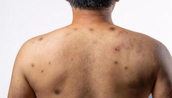 macro view of liver spots and uneven skin texture on the back, showcasing signs of aging in isolated white background photo