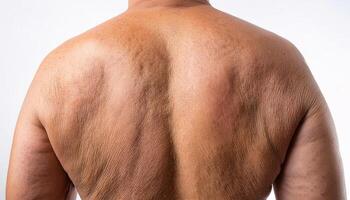 macro image of sagging skin on the back with visible folds natural texture and age-related wrinkles in isolated white background photo