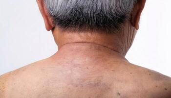 close-up of aged neck with deep folds, wrinkles, and uneven skin texture showing signs of aging on isolated white background photo