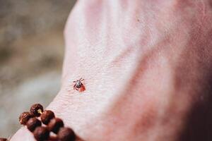 The tick crawls on the skin, looking for a place to bite, a dangerous insect, a carrier of Berlioz's infection and encephalitis. photo