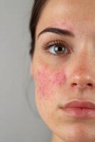 Skin condition highlighted on young woman's face in close-up shot photo