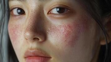 Portrait of a young person with freckles and skin blemishes in natural light photo