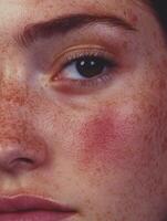 Close-up of a freckled face showcasing natural skin tones and textures photo
