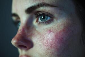 Close-up of a young woman's face highlighting unique skin texture and features photo