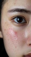 Close-up of a young woman's face showing skin imperfections and texture photo