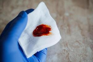 This is an intimate and closeup view of a bloodstained wipe that is being held by a gloved hand within a clinical and medical setting photo