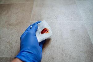 Cleaning Up Blood Stains Essential Proper Techniques and Important Precautions to Follow for Safety and Hygiene in Emergencies and Housekeeping photo