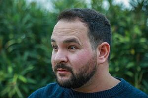 Surprised Man With Open Eyes photo