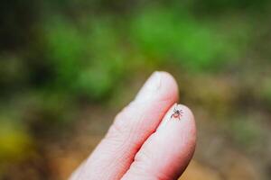 CloseUp View of Tiny Tick on Human Finger in a Natural Environment. This detailed image captures the risk of parasites and the importance of disease prevention photo