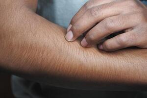 man suffering from itching skin, close up. photo