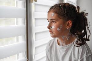 A sad little girl with a red rash on her skin is looking out the window. She has chicken pox and measles on her face. photo