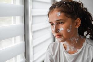 A sad little girl with a red rash on her skin is looking out the window. She has chicken pox and measles on her face. photo