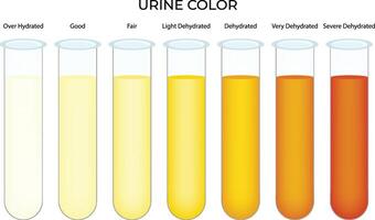 Urine Color Science Design Illustration Diagram vector