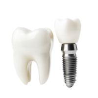 Dental implant and tooth model demonstrating effective tooth replacement on a clean transparent background, transparent teeth and dental implant Isolated on transparent background png