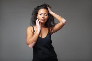 Confident fashion model with vitiligo with hand in hair in studio photo