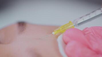 mesotherapy in modern cosmetology clinic, closeup view of syringe during injection in face skin video