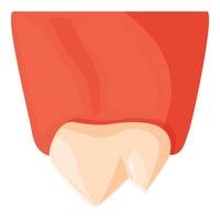 Inflamed gums exposing a broken tooth, dental health issues depicted vector