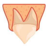 Impacted wisdom tooth under gum line, showing stage of eruption vector