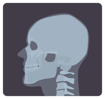 Lateral radiograph of skull. X-ray picture or radiographic image of head, side view. Modern medical radiography and human skeletal system. Monochrome illustration in flat cartoon style.