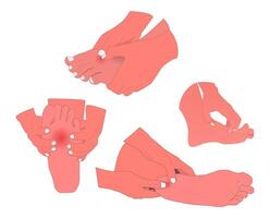 A set of illustrations of various foot health problems, designed with medical details yet aesthetic and easy to understand. for educational materials, medical presentations, or health content design. vector