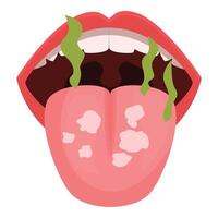 Open mouth showing halitosis and coated tongue representing oral problems vector