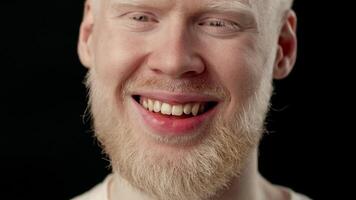 A young man with white skin and hair smiles warmly, highlighting his albinism. His features reflect light in a soft setting, creating an intimate and engaging atmosphere. video