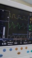 The screen of artificial lung ventilation apparatus working during surgery. Black monitor demonstration life signs of a patient under procedure. Doctors operating at backdrop. Vertical video
